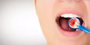 dental-patient-in-need-of-gum-disease-treamtent-1024x512